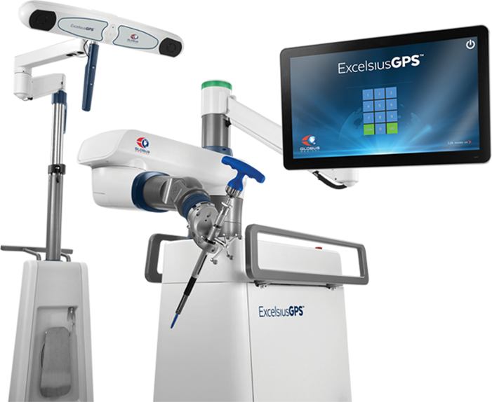 Globus Medical获取Stelkast,开发机器人联合重建系统