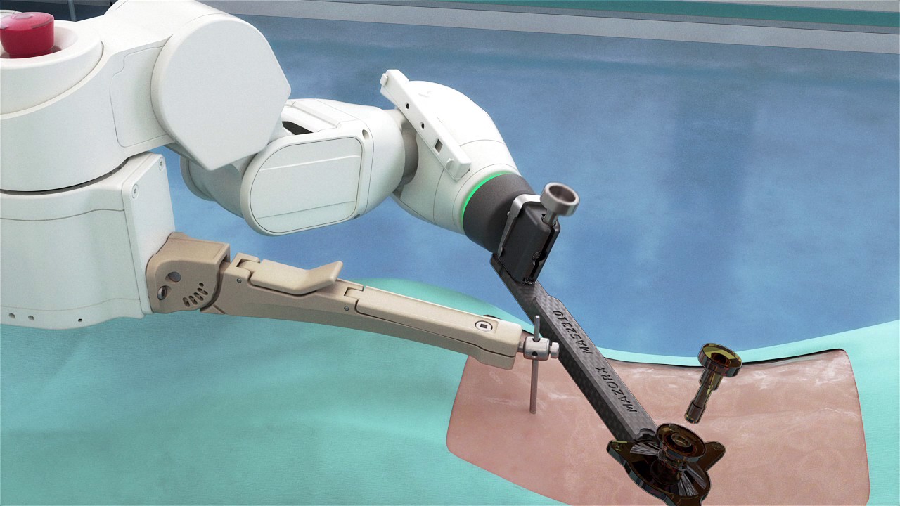 Medtronic Mazor X.