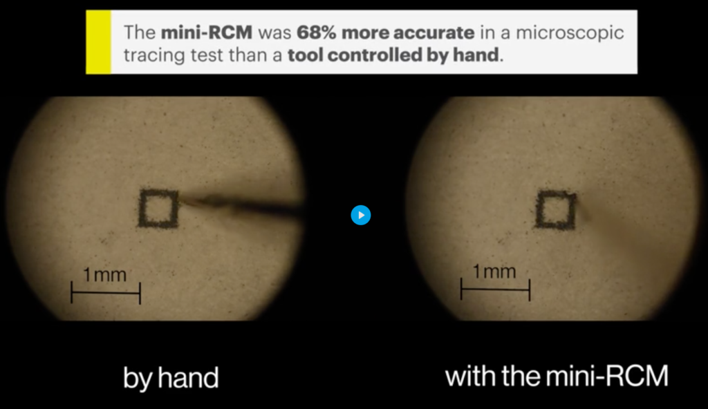 mini-RCM Wyss