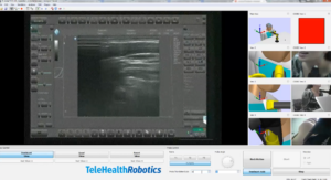 Telerobotics在Arm的医疗保健，工业用途提供自动化