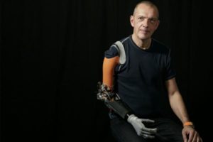 智能手臂团队开发假肢，以参加Cybathlon 2020全球版比赛